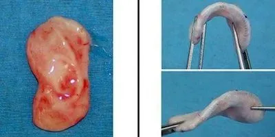 Build-Your-Body With Bazel Lab Grown Ear