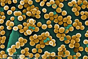 Blood Pressure Monitoring And Infection Control Blog Suntech Suntech Medical Blood Pressure Monitoring And Infection Control Blog Suntech Suntech Medical