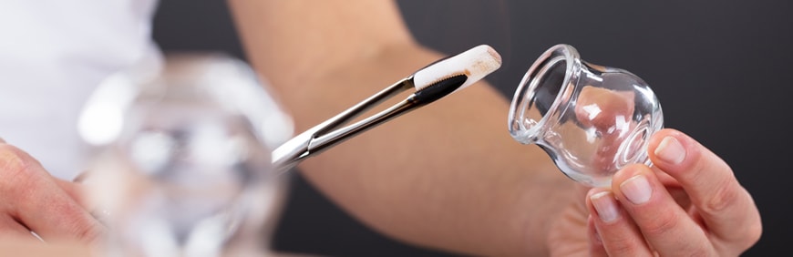 Is Fire Cupping Treatment Right For You?