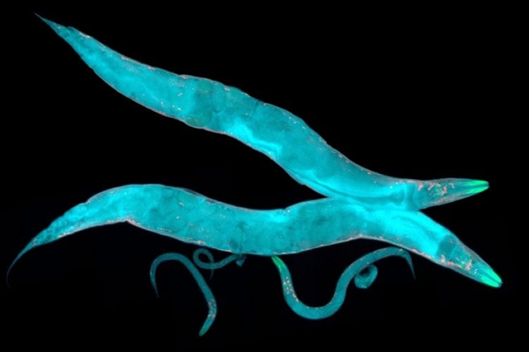 Gut Brain Connection Signals Worms To Alter Behavior While Eating Mit News Massachusetts Institute Of Technology Gut Brain Connection Signals Worms To Alter Behavior While Eating Mit News Massachusetts Institute Of Technology