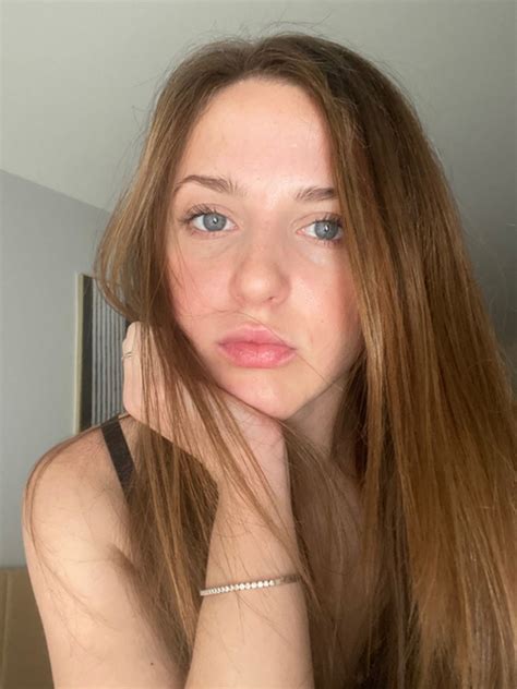 5 Secrets of Scars.wonderland